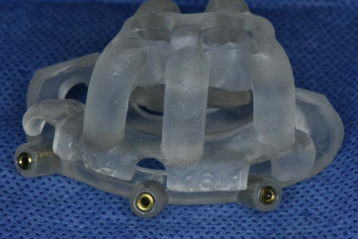Surgical guide for dental implant placement