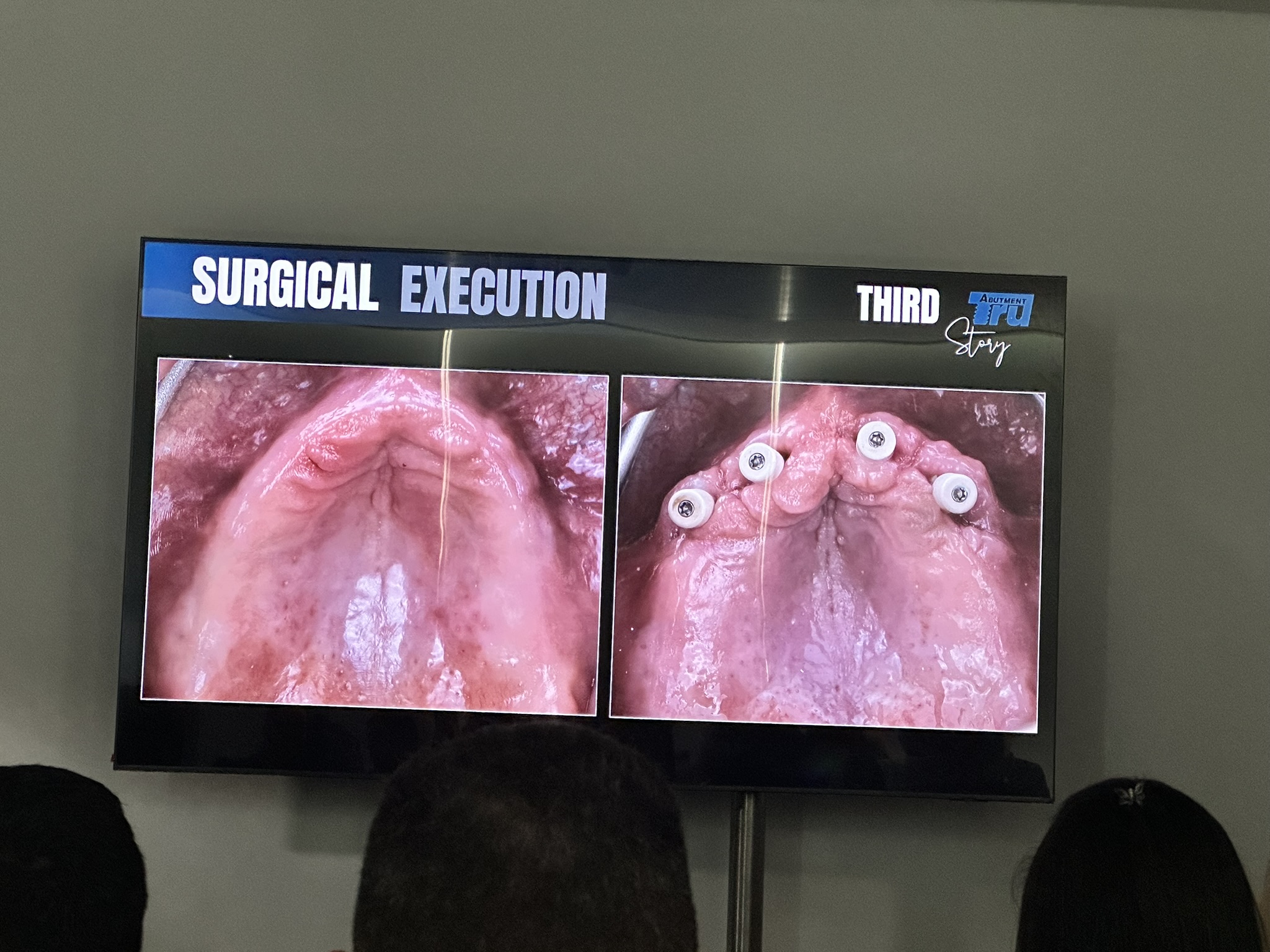 Dr. Alejandra Rodriguez Goncalves at EAO Congress 2026 Lisbon - foto 26