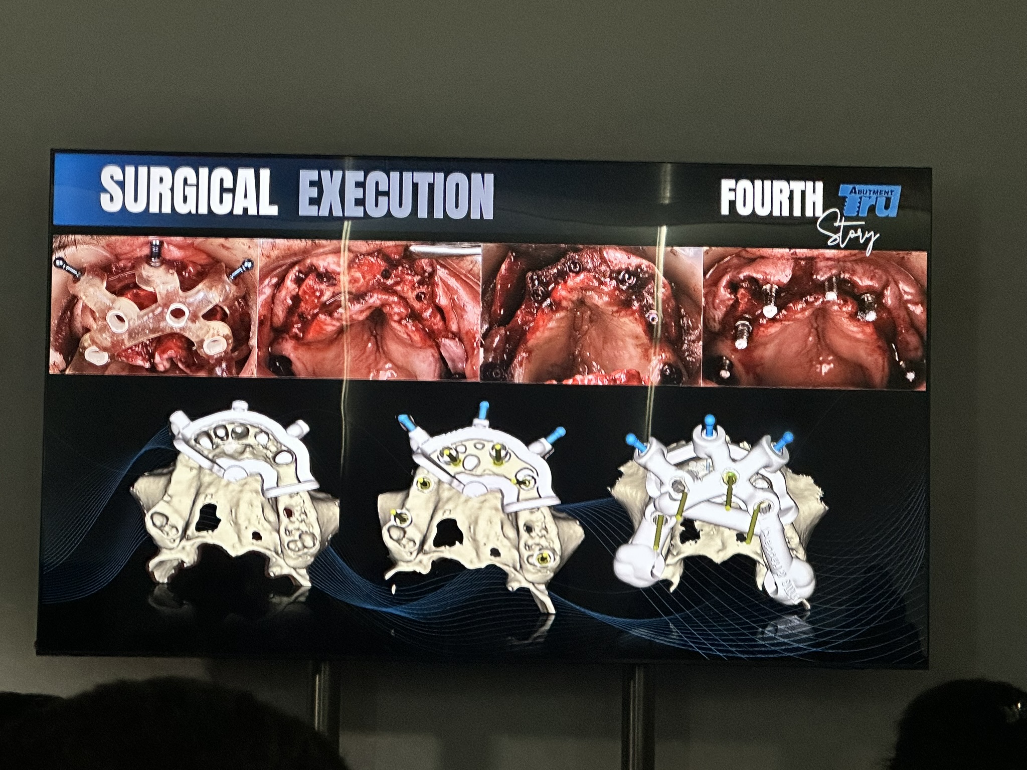 Dr. Alejandra Rodriguez Goncalves at EAO Congress 2026 Lisbon - foto 28